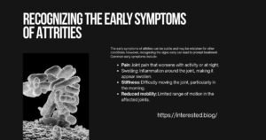 Attrities